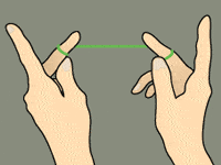 flossing diagram
