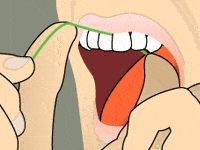 flossing diagram